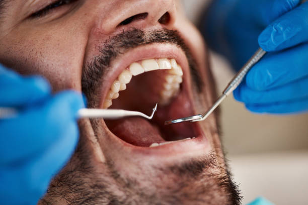 Best After-Hours Emergency Dentist in St George, MO
